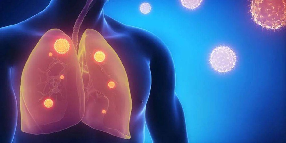清肺——从呼吸负离子开始